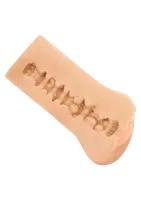 Bezhraničná vulva — obrázok 8